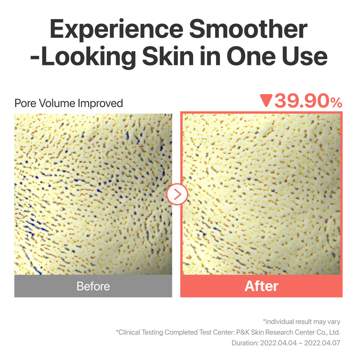 No.3 Tingle-Pore Softening Sheet Mask (5ea)