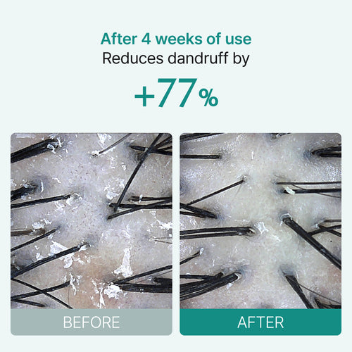 Scalp:Turn Cica PDRN Brush Ampoule 30ml