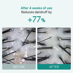 Scalp:Turn Cica PDRN Brush Ampoule 30ml