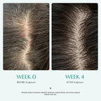 Scalp:Turn Cica PDRN Brush Ampoule 30ml