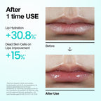 PDRN Lip Serum 10ml