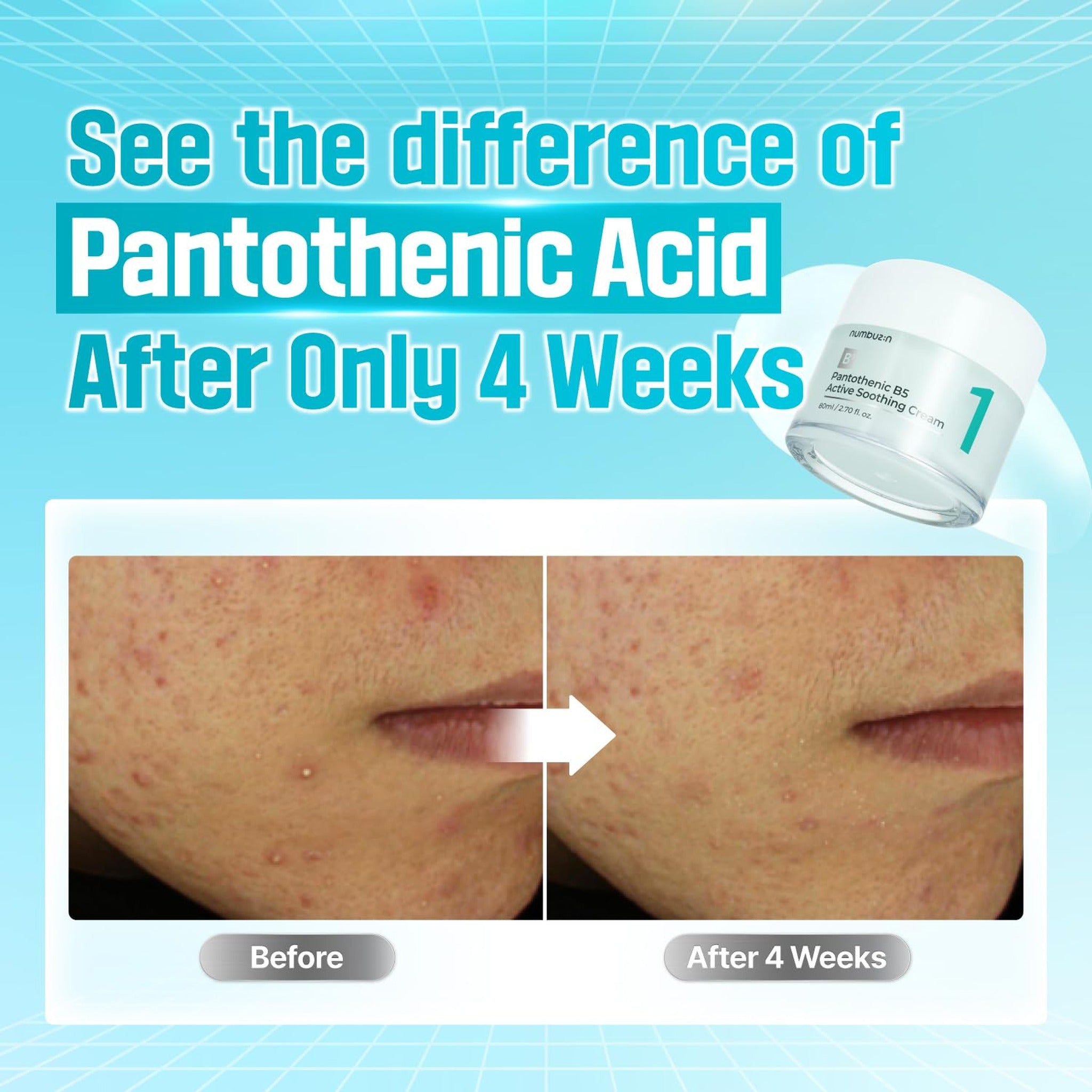No.1 Pantothenic B5 Active Soothing Cream 80ml - image 4