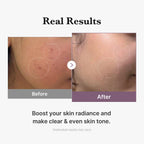 AGE-R GLUTATHIONE GLOW TONER 140ml - image 5
