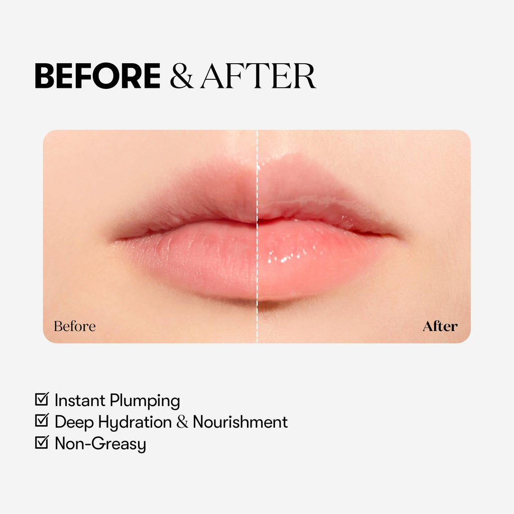 REEDLE SHOT LIP PLUMPER BEGINNER - image 5