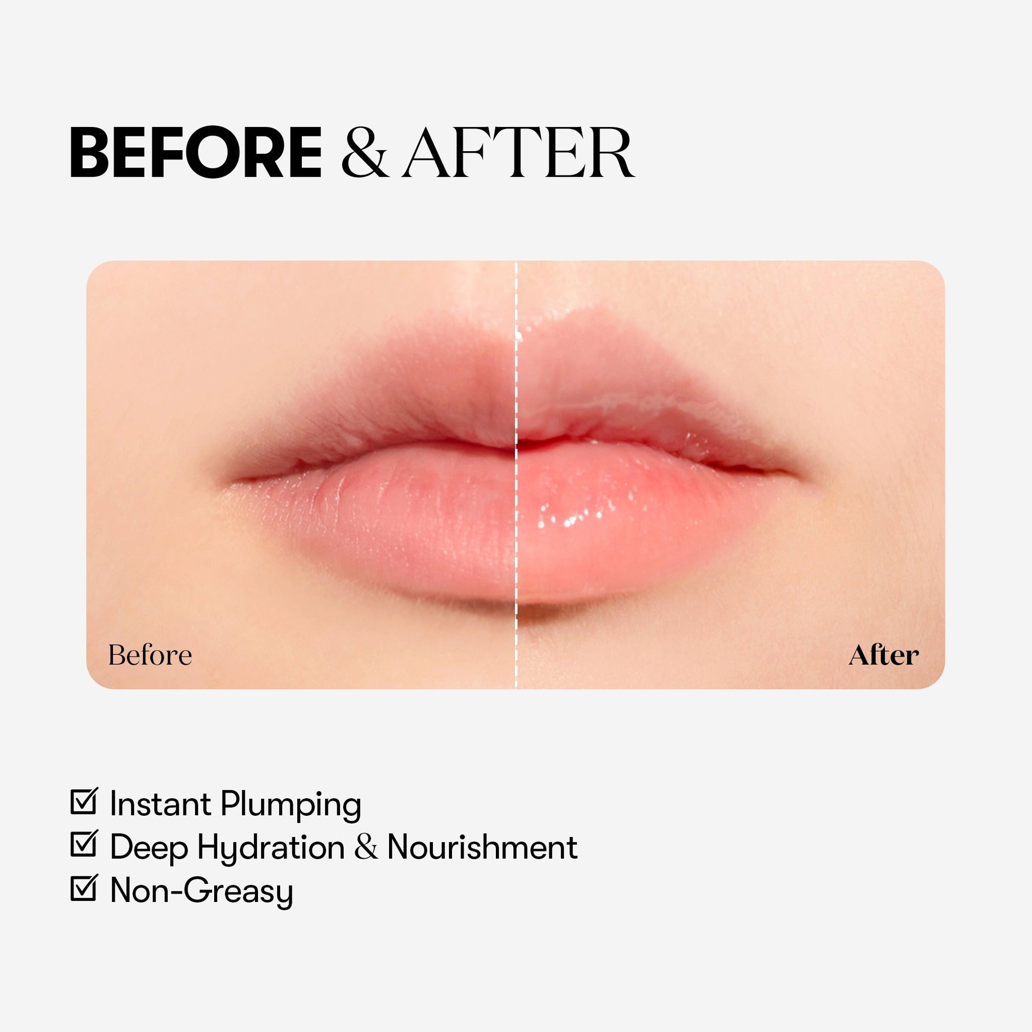 REEDLE SHOT LIP PLUMPER BEGINNER - image 5