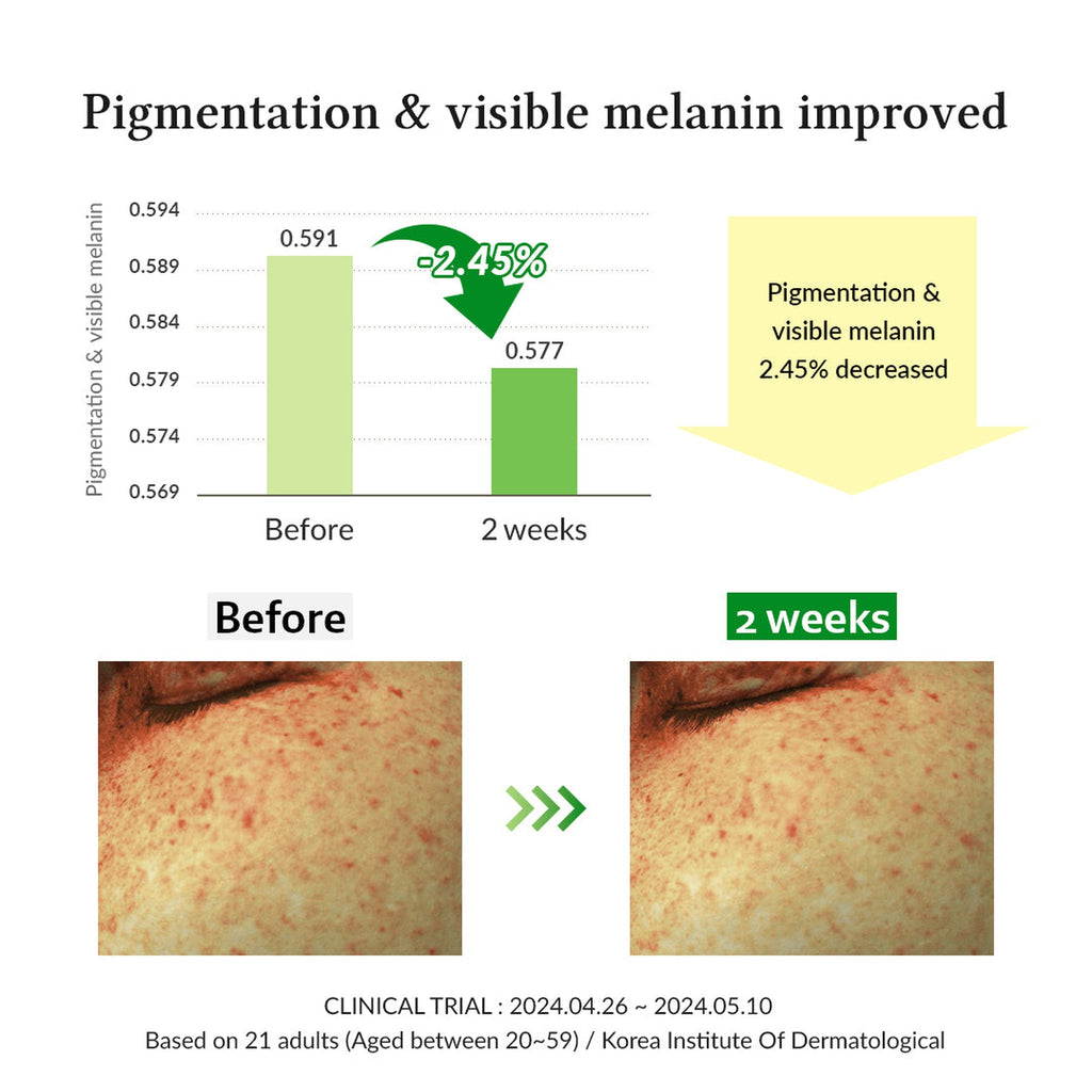 Gentle Vitamin C Serum 30ml - image 6