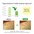 Gentle Vitamin C Serum 30ml - image 6