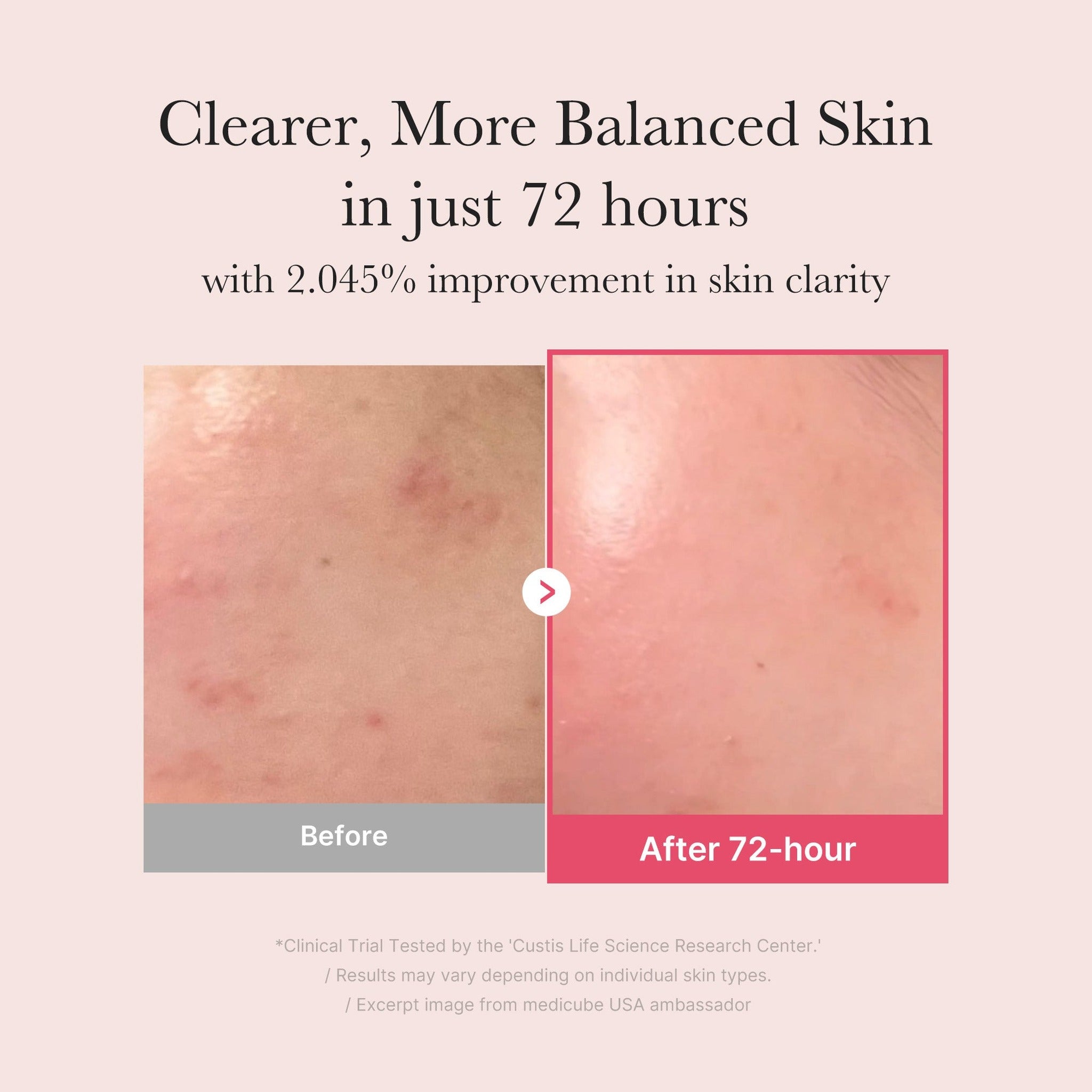 TXA NIACINAMAIDE 15 SERUM 30ml - image 3