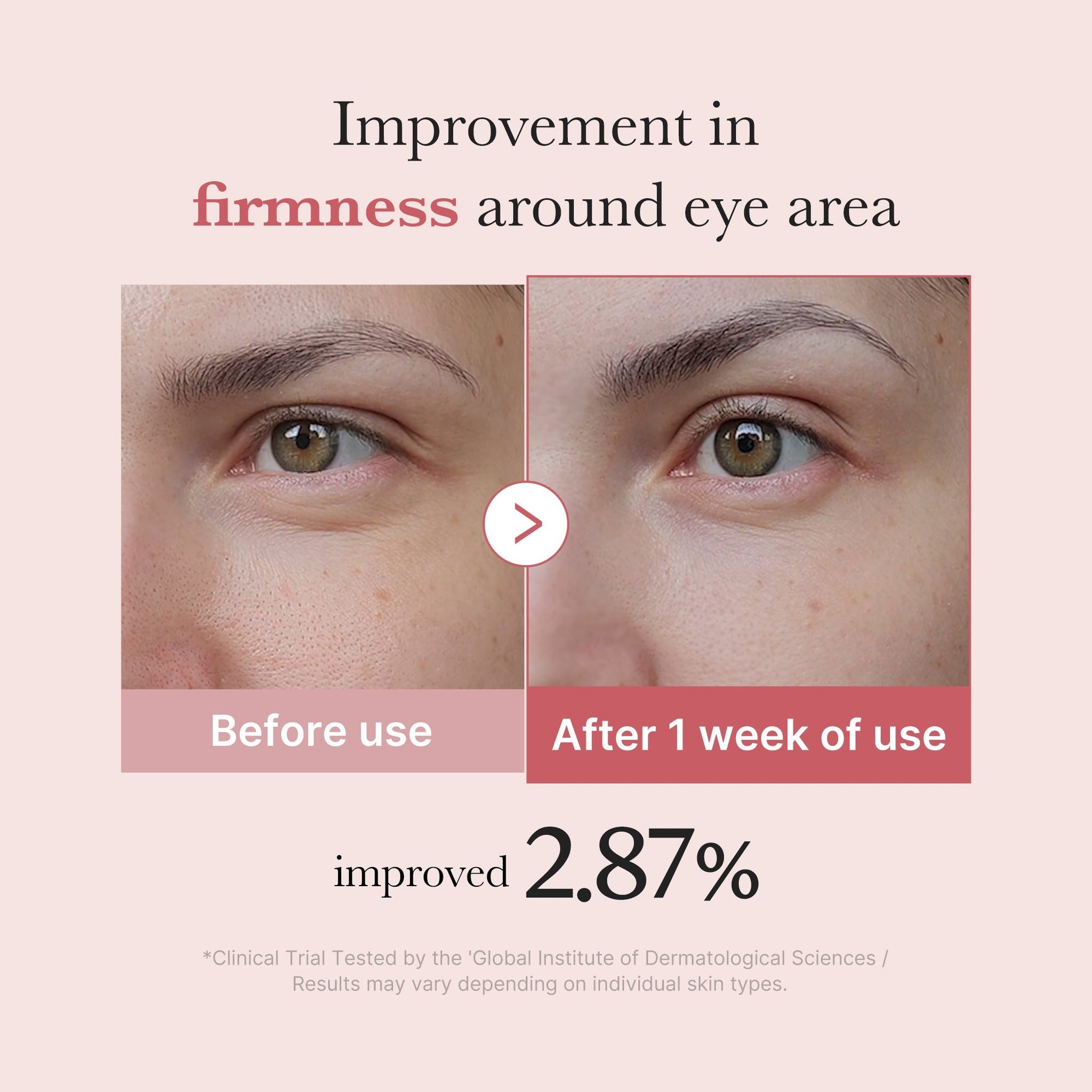 PDRN PINK PEPTIDE EYE CREAM 30ml - image 4