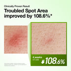 Azelaic Acid 10 Hyaluron Redness Soothing Serum 30ml - image 4