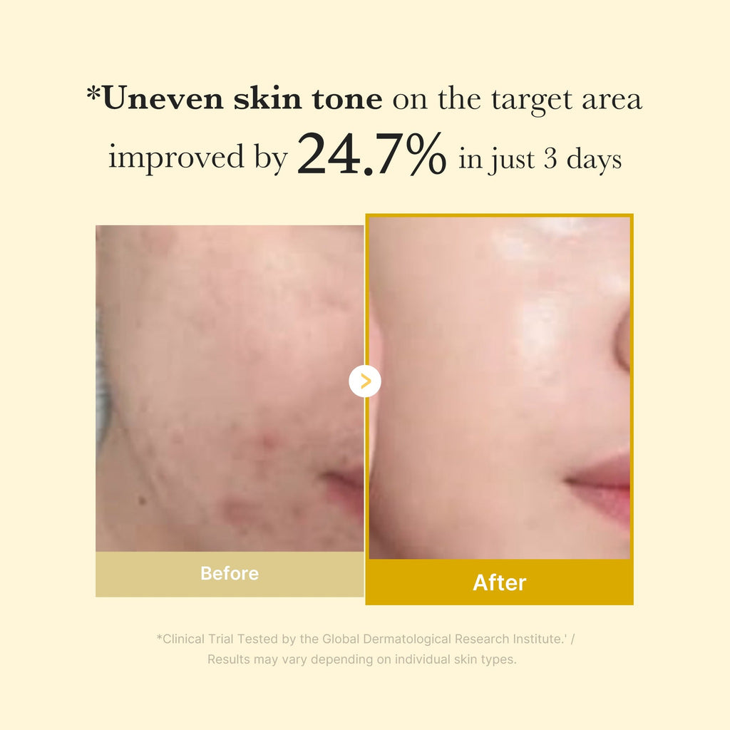 KOJIC ACID TURMERIC NIGHT WRAPPING MASK 75ML 2.0 - image 8