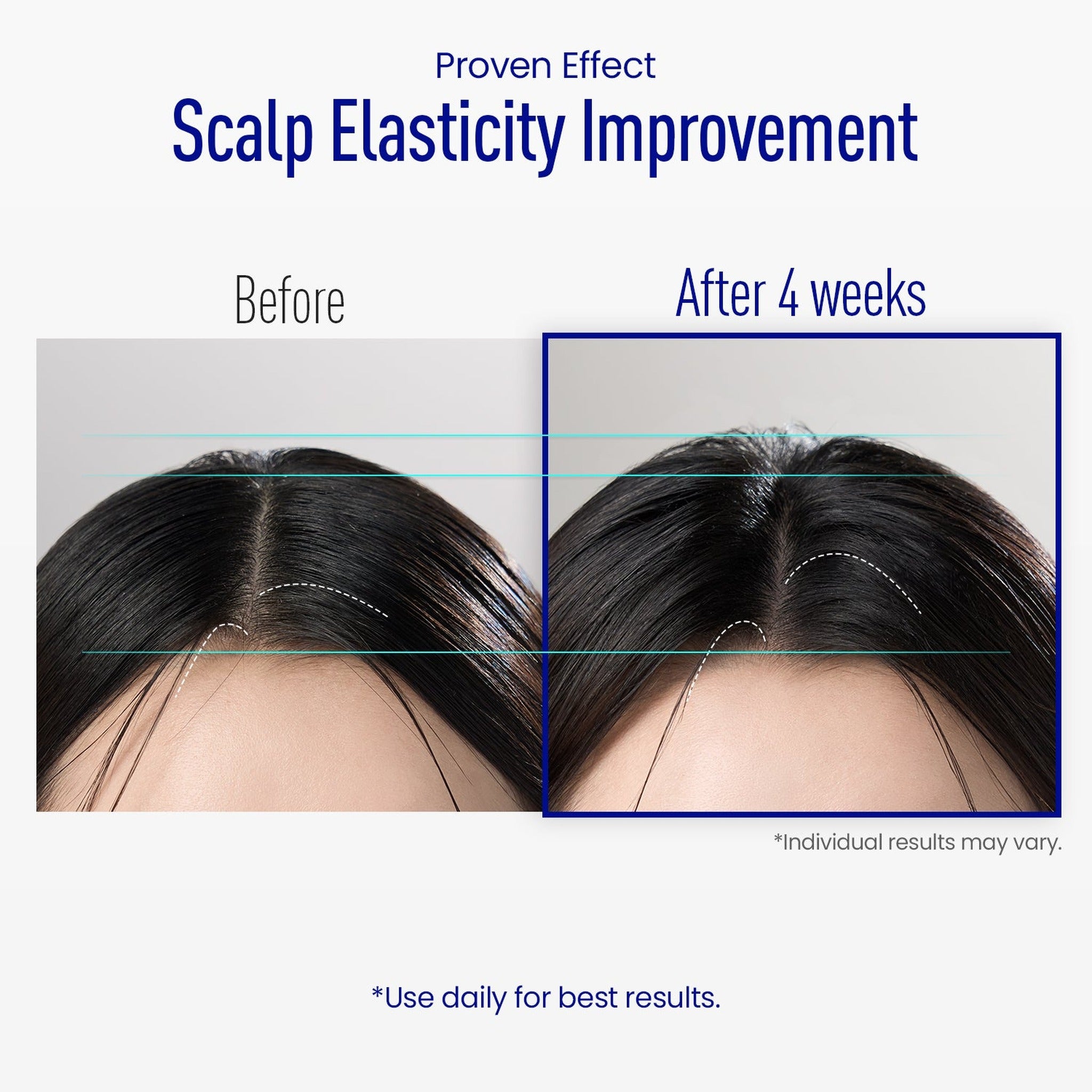 Revive Therapy  Hair Scalp Enhancing  Foam 100ml - image 3
