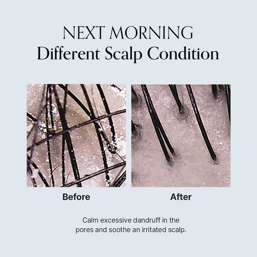 Damage Therapy Scalp Scaling Ampoule 30ml - image 6