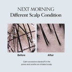 Damage Therapy Scalp Scaling Ampoule 30ml - image 6