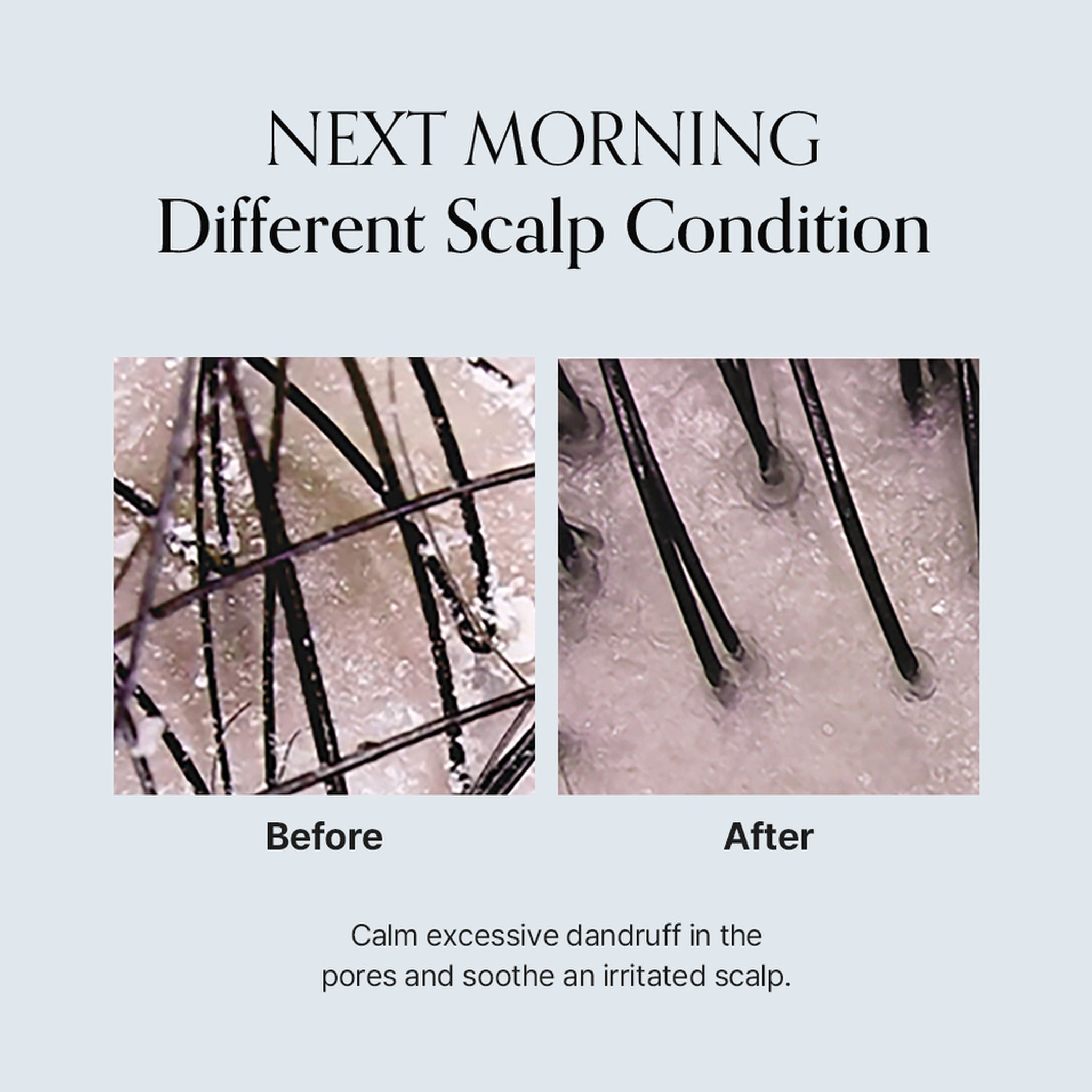 Damage Therapy Scalp Scaling Ampoule 30ml - image 6
