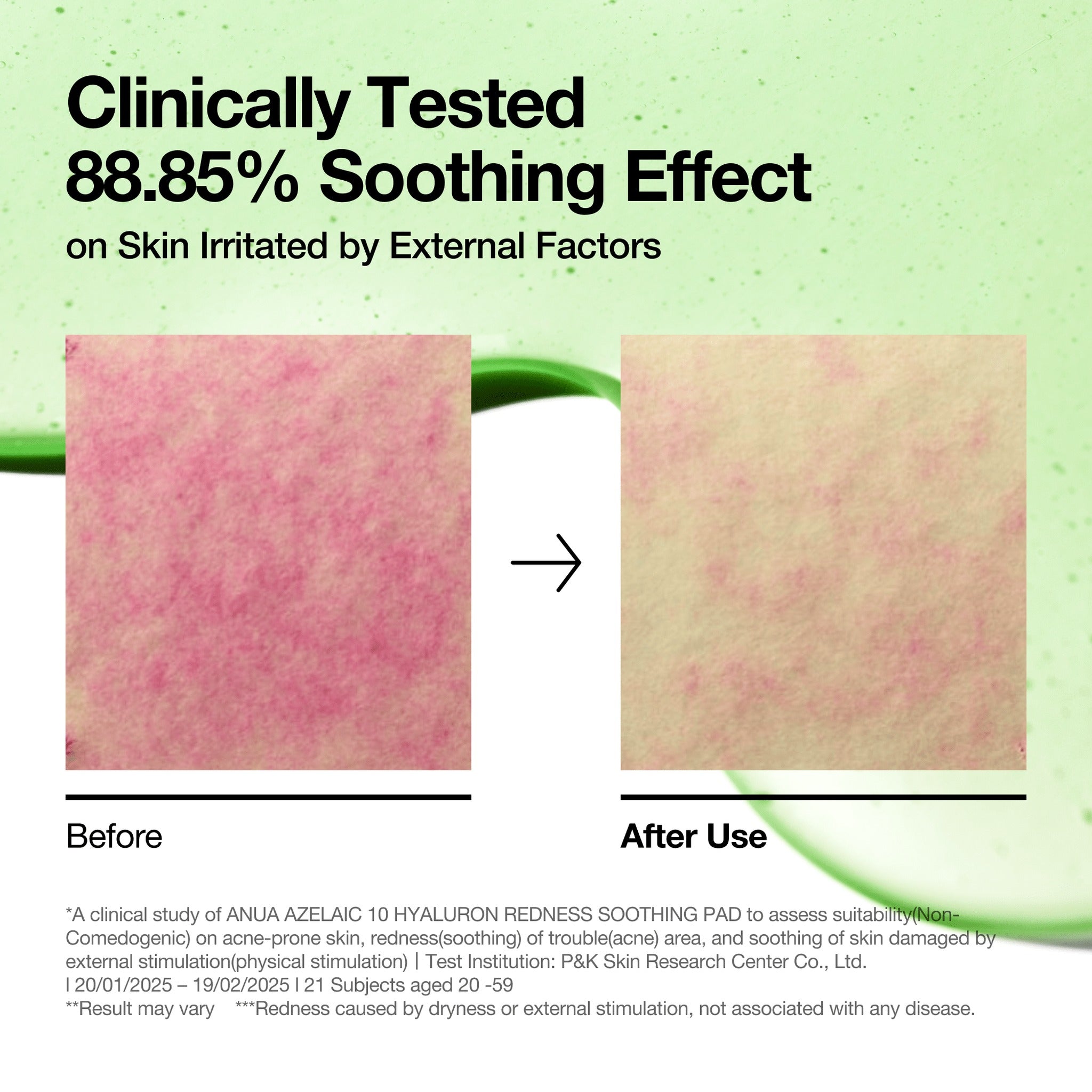 AZELAICACID 10 HYALURON REDNESS SOOTHING PAD 230ml (90EA) - image 3