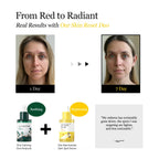 (Renewal) VITA NIACINAMIDE DARK SPOT SERUM 30ml - image 4