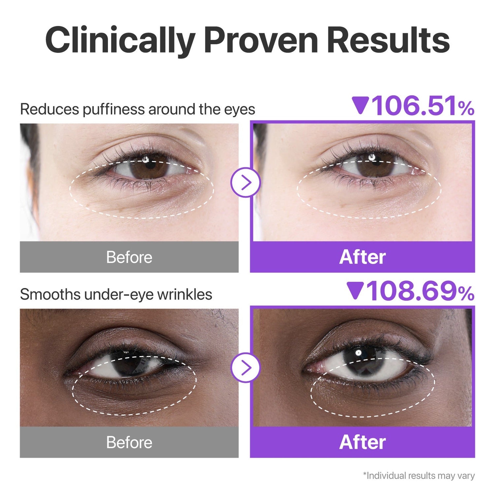 5ea) No.9 NAD Collagen Under Eye Patches - image 4