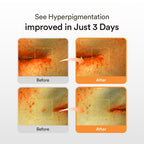 GLUTATHIOSOME DARK SPOT SERUM VITA DROP 50ml - image 2