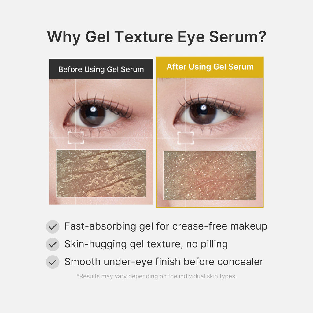 kojic-acid-turmeric-vita-eye-gel-serum-30ml-mecus14-is - lifestyle