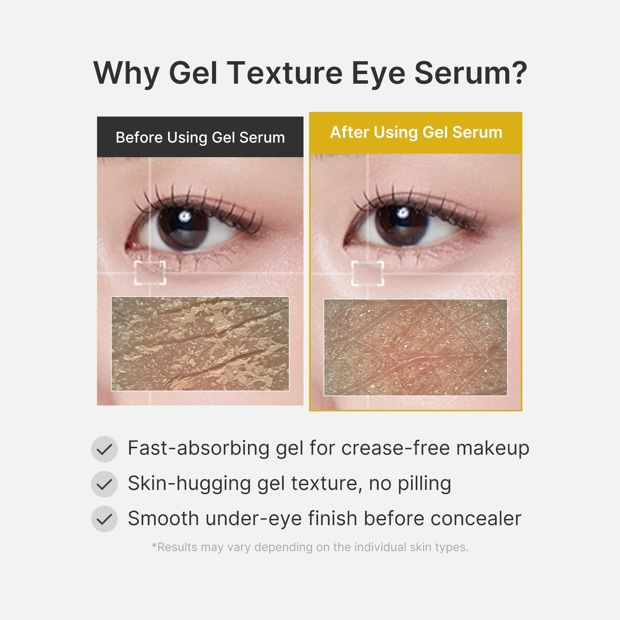kojic-acid-turmeric-vita-eye-gel-serum-30ml-mecus14-is - lifestyle