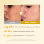 KOJIC ACID TURMERIC PAD  70pcs - image 4