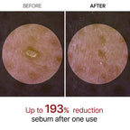 PEEL SHOT EXFOLIATING WHITE RICE AMPOULE 80ml - image 4