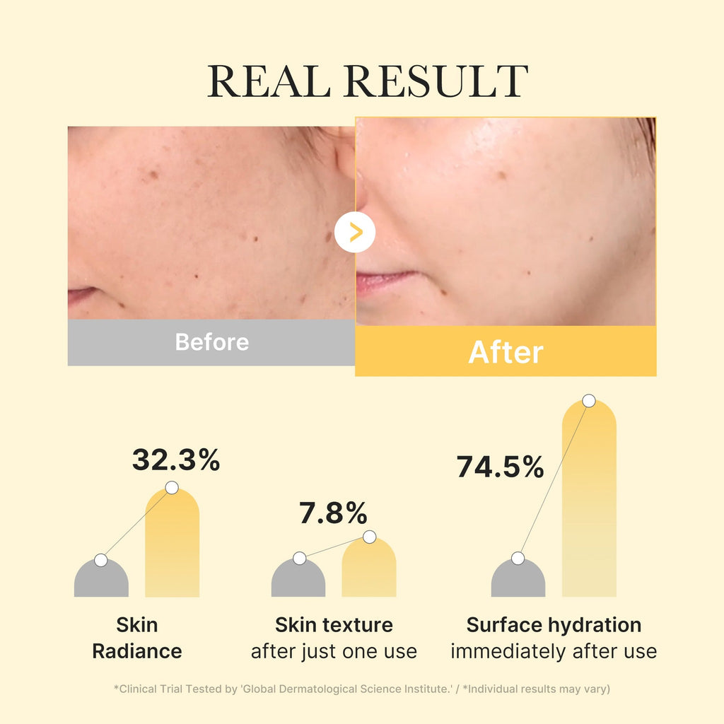 KOJIC ACID TURMERIC BRIGHTENING GEL MASK 4ea - image 4