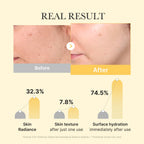 KOJIC ACID TURMERIC BRIGHTENING GEL MASK 4ea - image 4