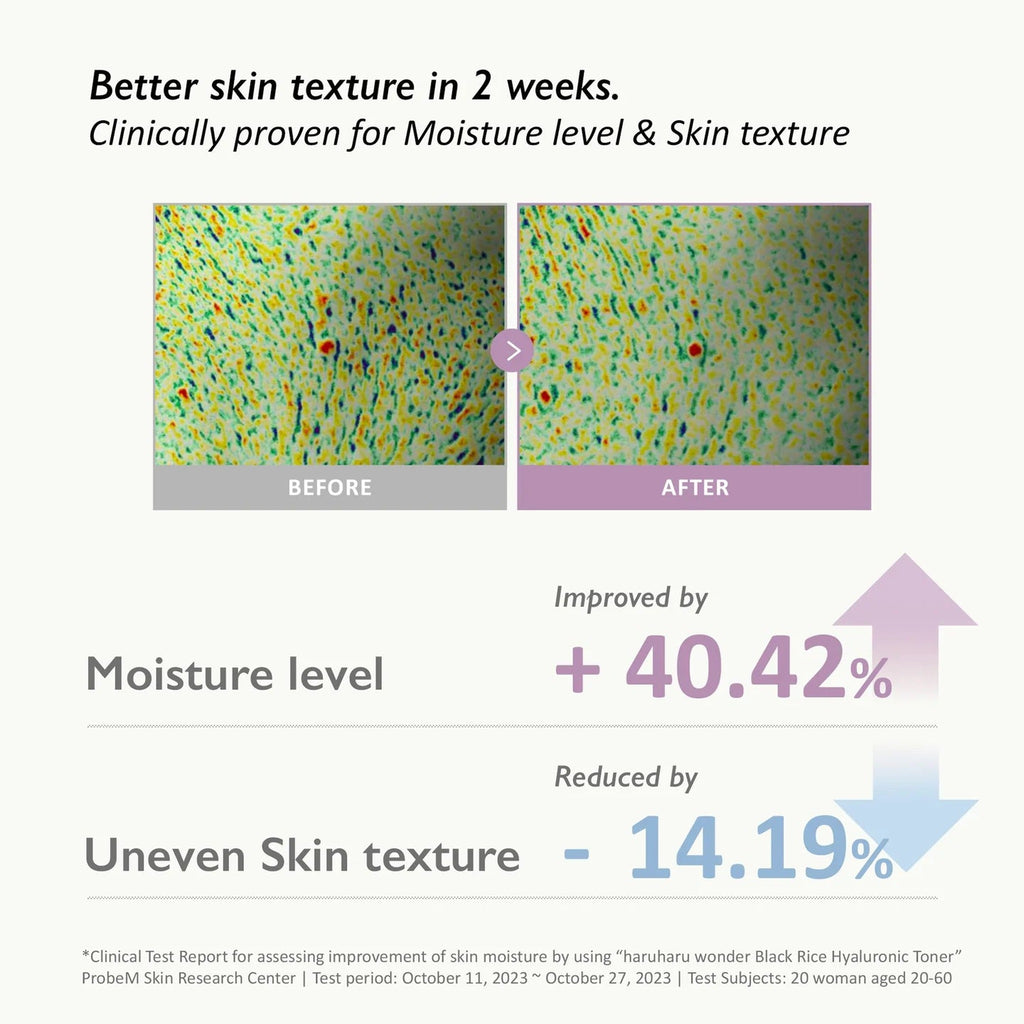 WONDER Black Rice Hyaluronic Toner 300ml - image 7