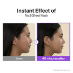 (4EA) No.9 NAD Bio Lifting Full Cover Facial Mask (+GWP) - image 5