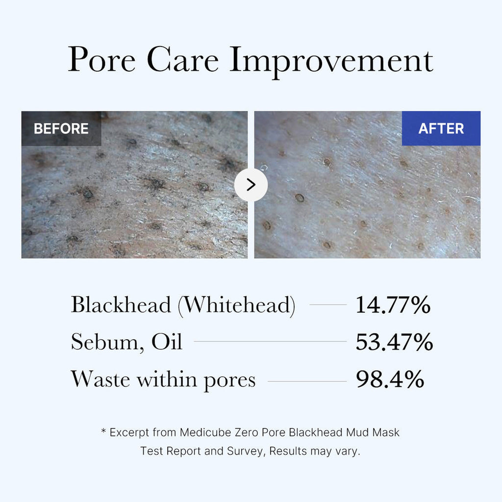 ZERO PORE BLACKHEAD MUD MASK 100g - image 5