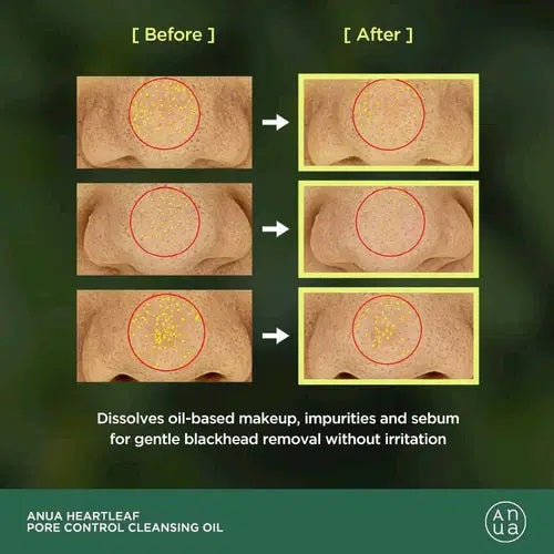 Anua Heartleaf Pore Control Cleansing Oil before and after results